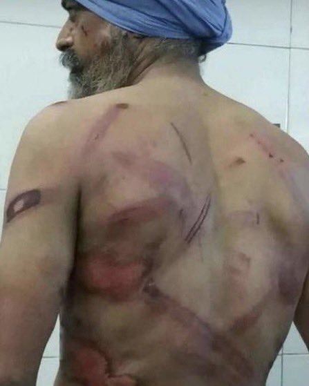 Although the protests have been peaceful they have been met with aggressions of the Indian police, the government and government controlled media. Over the past week violence against protesters has escalated even more: