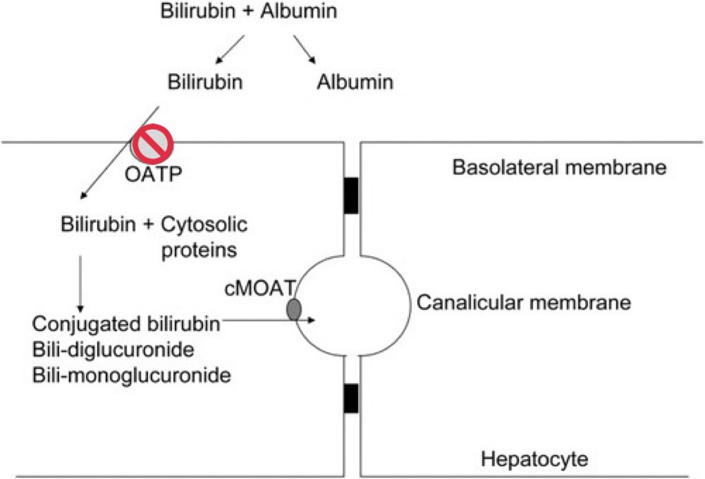 @KristelLeung I’m glad you asked! 

If hospitalized, more likely to have acute (on chronic) inflammatory process +/- infxn

Inflammation (ie. TNF-a and IL-1b) causes downregulation of basolateral uptake protein OATP. So less UCB is able to get into hepatocyte for conjugation. (PMID: 23276972)