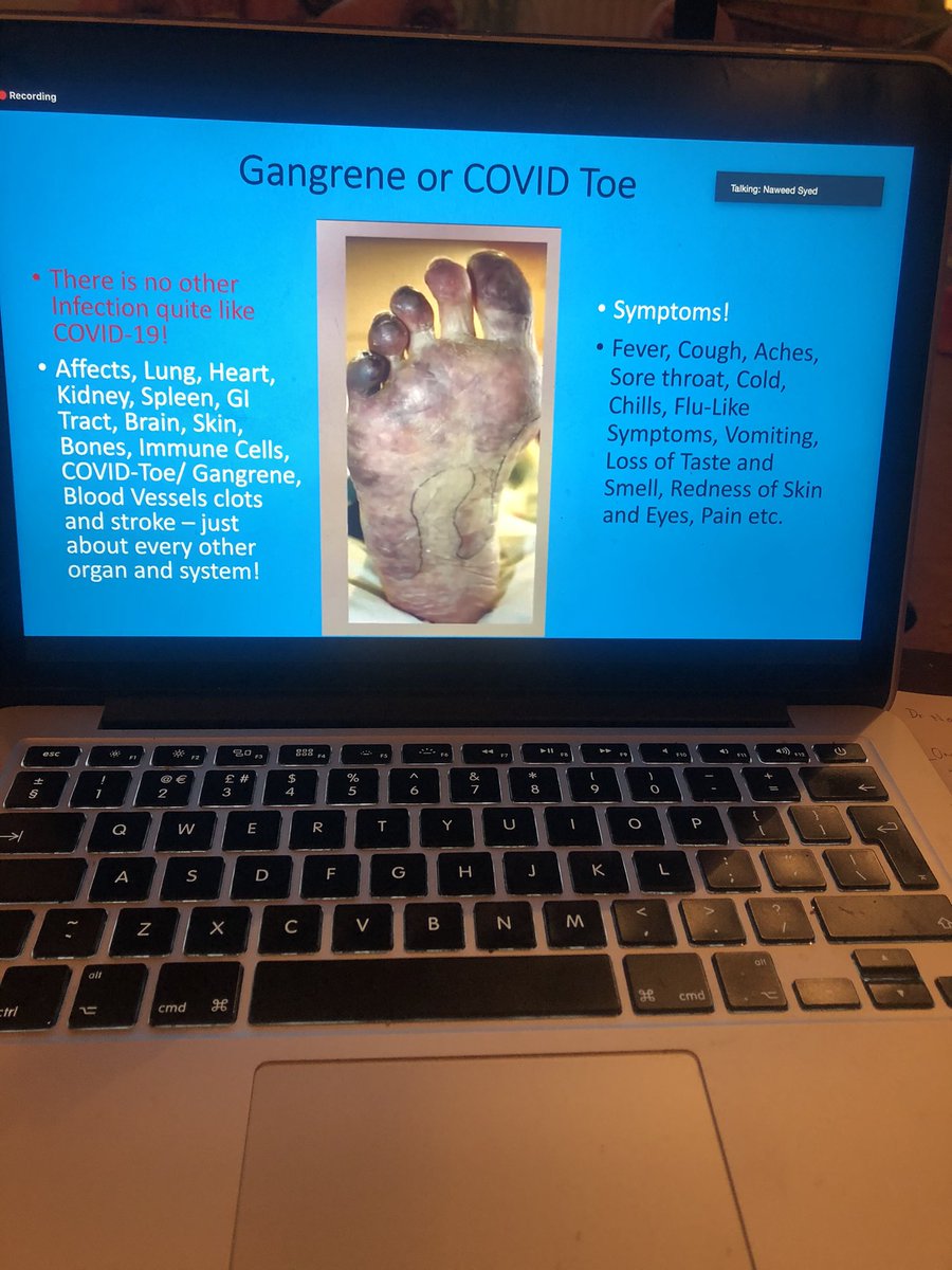 We are also seeing covid toe in patients.