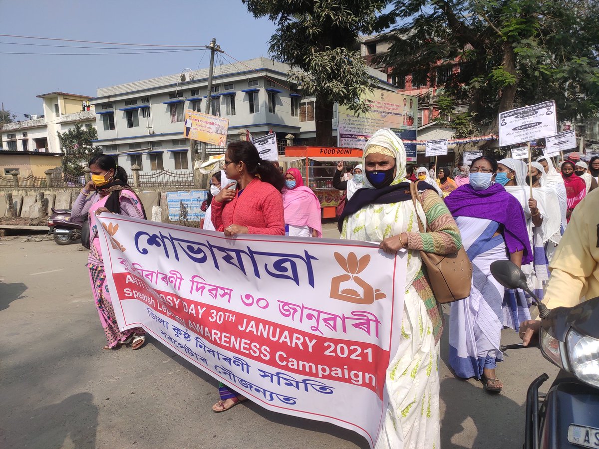 Rally for Anti leprosy day flagg off by the Deputy commissioner, Barpeta in the presence of the Jt.Director of Health services, Barpeta and other officials. 
<a href="/nhm_assam/">NHM_Assam</a> <a href="/airnews_ghy/">AIR News Guwahati</a> <a href="/diprassam/">DIPR Assam</a> <a href="/DCBarpeta/">Deputy Commissioner Barpeta</a> <a href="/onhelloguwahati/">Hello Guwahati</a>