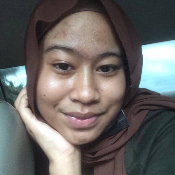 jyazndn's tweet photo. Korangggg tengok la customer ni dia pakai full set mimpimika tak sampai seminggu dah nampak perubahan especially dekat dahi! 😍 

Selain guna skincare, makan pun kena jaga tau. jangan makan benda berminyak, fast food no no!☝🏻bed sheet, pillow case pun kena cuci selalu https://t.co/Hysfvbo9aI