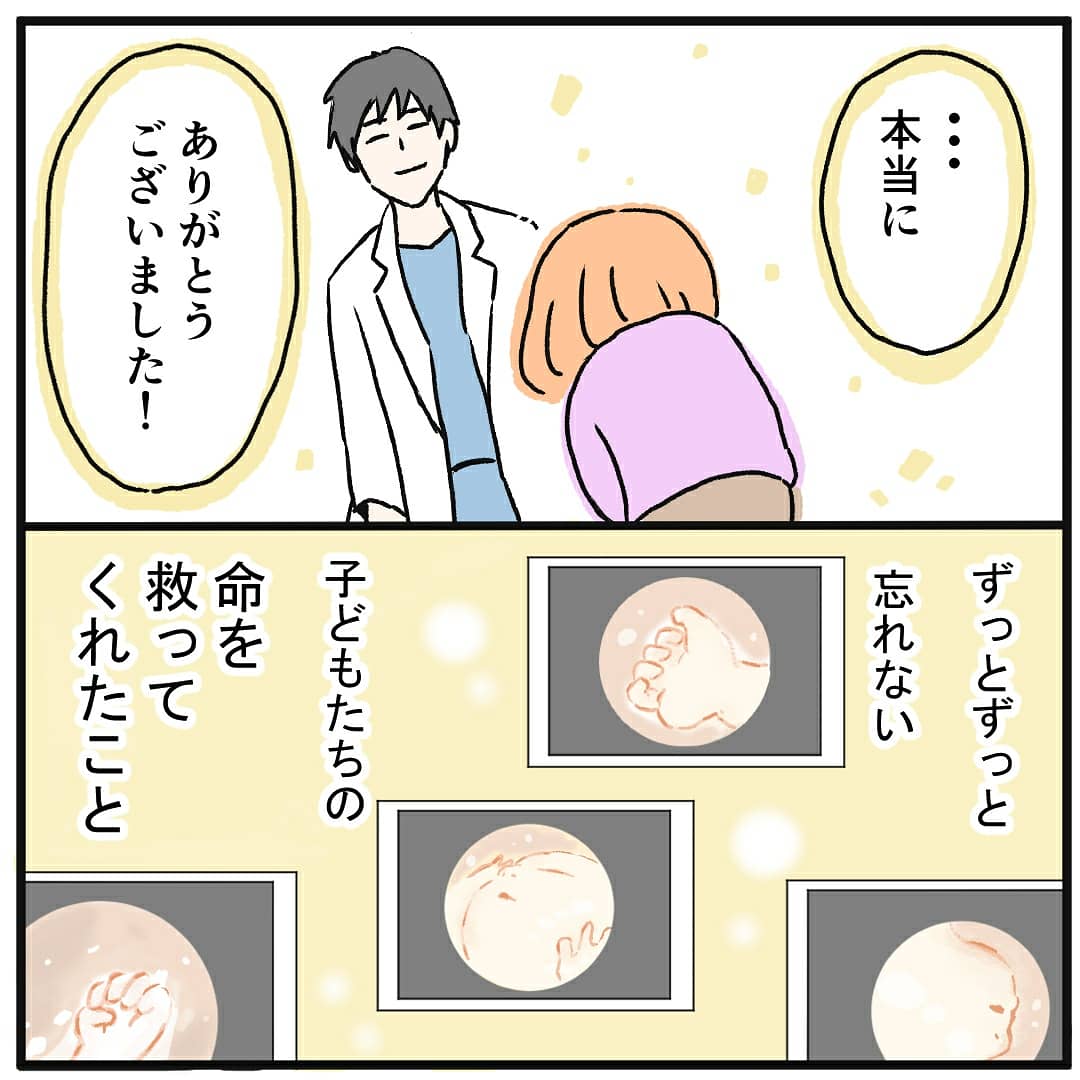 TTTS(双胎間輸血症候群)になった話(16)
#ttts
#双胎間輸血症候群
#出産レポ 