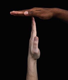 des albinos et qu’elle ne voulait pas avoir ce genre de gène en elle.J’avais tellement eu mal qu’après j’ai décidé de ne plus faire le premier pas et de laisser les autres venir à moi plutôt.Comme moi, beaucoup continuent à vivre ce genre de situation. La faute à qui ?