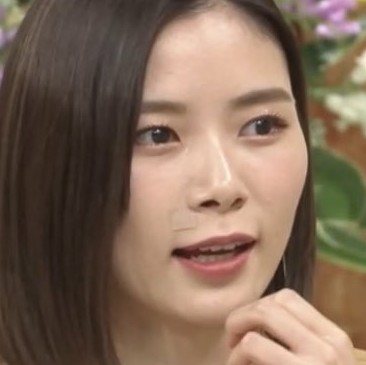 朝日奈央のホクロはどこの病院でとった 除去した時に絆創膏を貼っていた画像はどれ Tv番組から発見 気になる有名人