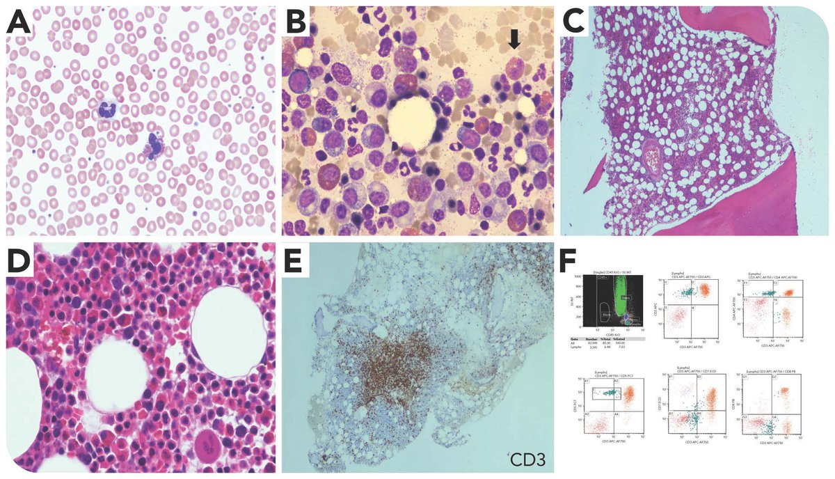 Blood Journals Portfolio tweet media