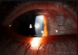 Global Pharmacist tweet media