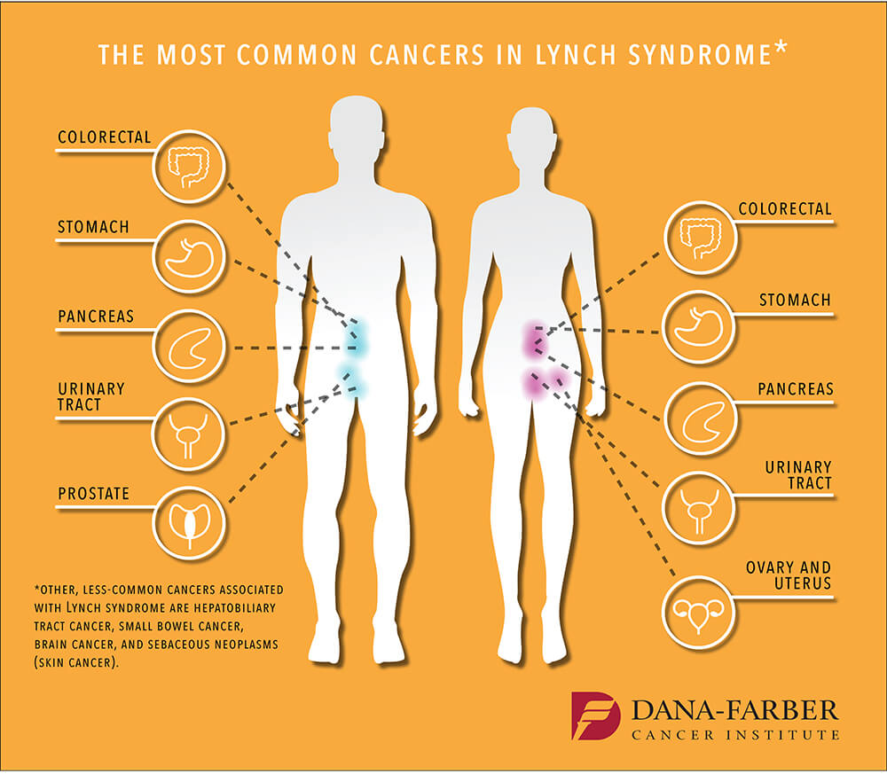 drkeithsiau's tweet photo. Lynch Syndrome (aka HNPCC)

👨🏻‍⚕️ Henry Lynch 1966
🧬 MLH1, MSH2, MSH6, PMS2
✳️ 50%➡️👨‍👩‍👧‍👦
🔎 1/500; 3% of all CRCs
⚠️ Cancers👇

👨🏻‍🏫 Amsterdam criteria (3-2-1 ✅):
3️⃣ 👨‍👩‍👧‍👦 with CRC (1x FDR)
2️⃣ generations
1️⃣ 👨‍👩‍👧‍👦 Dx <50yrs

🔦 Screening (50-80%➡️CRC)
🏁 Age 25 (35 if MSH6/PMS2)
🗓 2yrs https://t.co/WcIn3PcD6f