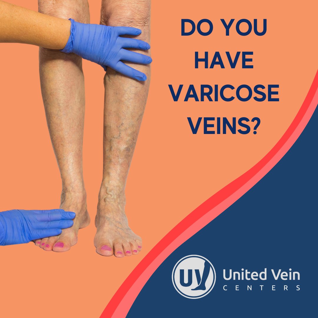 Do you have varicose veins? Learn the difference at UnitedVeinCenters.com and schedule your free vein screening today. 

📞 866-381-7891 bit.ly/2ISErC7  
#UnitedVeinCenters #VeinClinic #VeinDoctor #VaricoseVeinTreatment #VaricoseVeins
