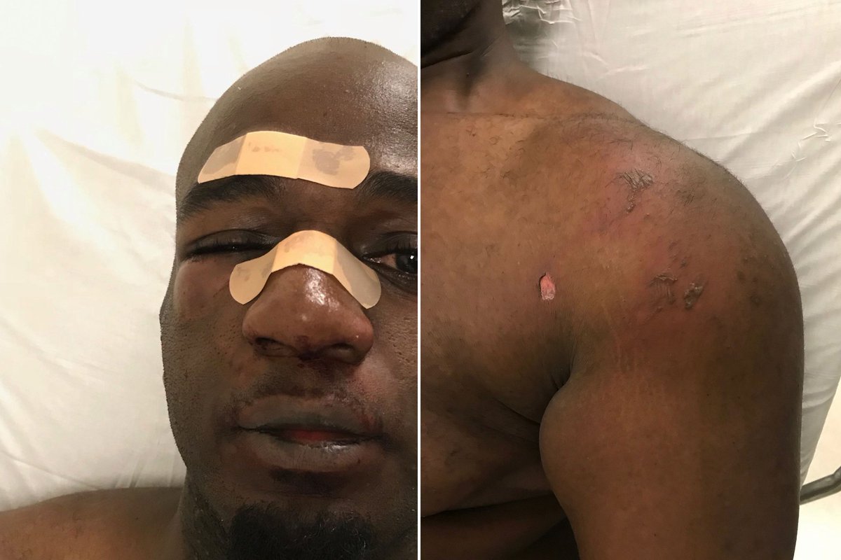 The International Community needs to recognize that the same social forces that's killing people on the streets is full throttle in the prisons and jails throughout amerika  #prisonershumanrights