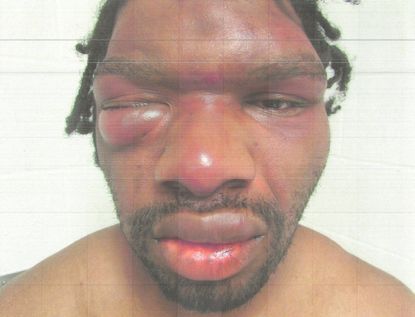 The International Community needs to recognize that the same social forces that's killing people on the streets is full throttle in the prisons and jails throughout amerika  #prisonershumanrights