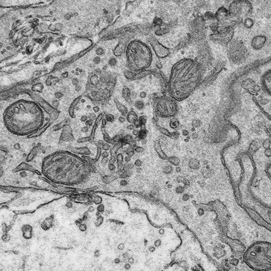 Electron Microscopy at uOttawaMed tweet media