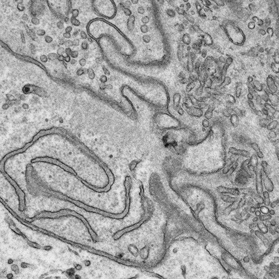 Electron Microscopy at uOttawaMed tweet media