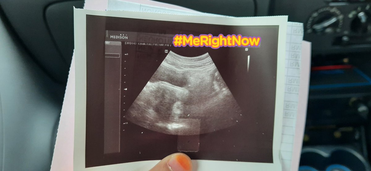 NSubrie's tweet photo. D-9 until the comeback. But I can't do much this time. 배진영, noona get a good news this week. Something I didn't expect he/she will come to me this early. Bcoz of severe morning sickness, noona cannot focus for your comeback. I'll make sure to repay it later. Miss you. https://t.co/QyeionpyON