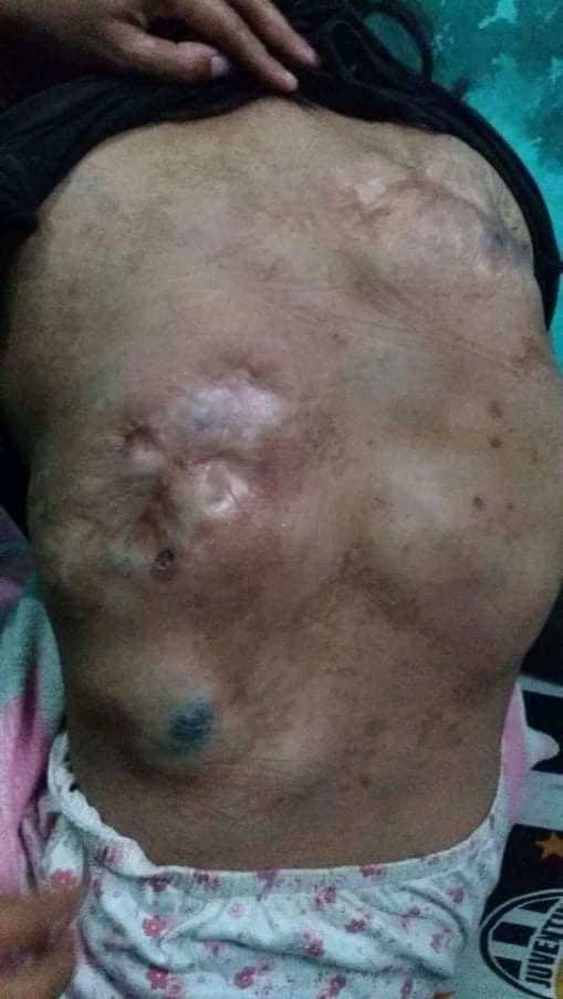 Bismillahirrahmanirrahim 🙏🏻
Twitter please do your magic.

Ini temenku namanya Chintya, usianya 18th. Anak pertama dari 3 bersaudara. Chintya menderita sakit kanker kelenjar pembuluh darah sejak usia 2thn sampai sekarang.