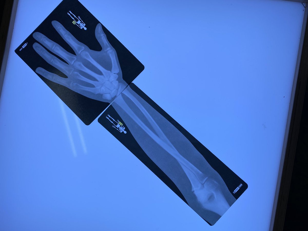 PrincipalFan1's tweet image. Pre-K 4-5 enjoyed learning g about light #light #lightunit #xrays @ArchNY_Schools @ARCHNY_OEC @BXNEEBSchools