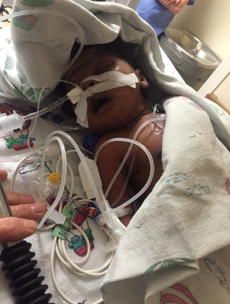 Finetrends_'s tweet photo. January 22, 2016 my son had his first open heart surgery 💔🪢 #FckCHD MY SON HARD BODY!! https://t.co/RjvA0MTnTI