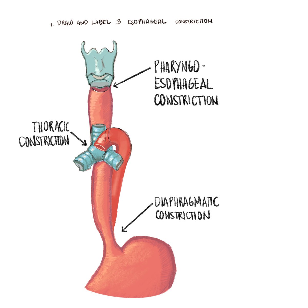 Esophagus Constriction Diagram