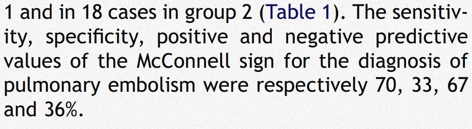They were all done in pts w/ suspected or known PE, whereas other studies that included different etiologies found an overall poor sp. Like this one by Casazza et al. that evaluated its prevalence in PE confirmed pts vs RV infarction. Sp only 33%!PMID: 15664548
