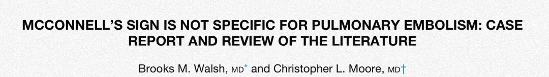 Finally, I'll leave a cool case by  @BrooksWalsh of a pt w/ McConell's and no vascular occlusion on CTA. Hope you've enjoyed the thread!DOI: 10.1016/j.jemermed.2014.12.089