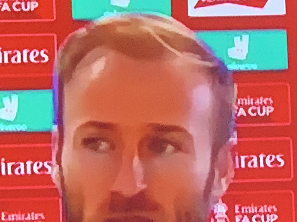 GazEd088's tweet photo. @TD999MUFC @RWC_1980 @pheloefc are you playing tonight straw head...? #strawhead Mk 2 worst mullet than yours kid..! #strawhead #mullet https://t.co/xRHuvJS9w9