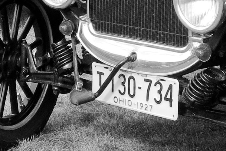 24. A CHAUFFEUR’S FRACTURE is a fracture of the radius bone, so named because it so often affected drivers turning the starting handles of early motor cars.