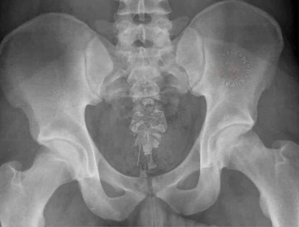 DrLawsonNP's tweet image. Where’s Bernie?