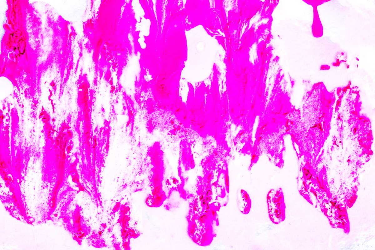 Les_Roberts_'s tweet photo. Get noticed for your good taste.
#abstractart #chromography #vietnam #vision #digitalartists #creation #Wales #Cymru #canson #artwork #canvas #artgallery #unique #activatepaint #exhibition #artoftheday #imaginative #paintmanipulation
Les Roberts @ https://t.co/fzS3mOhHHW https://t.co/5qw5AhmO8d