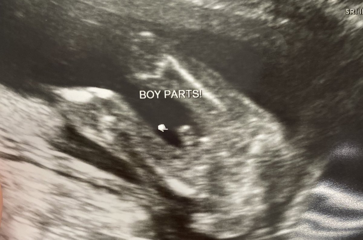 wigglemont04's tweet photo. I never posted it on here but Baby Swan #2 is a boy! 
Michael Waylon Swan and he will go by Waylon 💙💙💙 https://t.co/r2lEICRy0I
