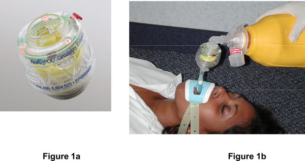The Prehospital Resuscitation IMpedance valve and Early vs Delayed analysis (PRIMED) measured two interventions.Q1: Did an Impedance Threshold Device (ITD) improve survival?A1: No.  https://www.nejm.org/doi/10.1056/NEJMoa1010821?url_ver=Z39.88-2003&rfr_id=ori:rid:crossref.org&rfr_dat=cr_pub%20%200pubmed