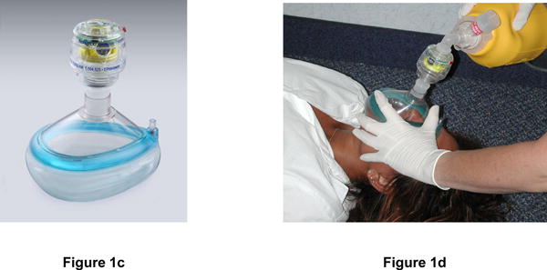 The Prehospital Resuscitation IMpedance valve and Early vs Delayed analysis (PRIMED) measured two interventions.Q1: Did an Impedance Threshold Device (ITD) improve survival?A1: No.  https://www.nejm.org/doi/10.1056/NEJMoa1010821?url_ver=Z39.88-2003&rfr_id=ori:rid:crossref.org&rfr_dat=cr_pub%20%200pubmed