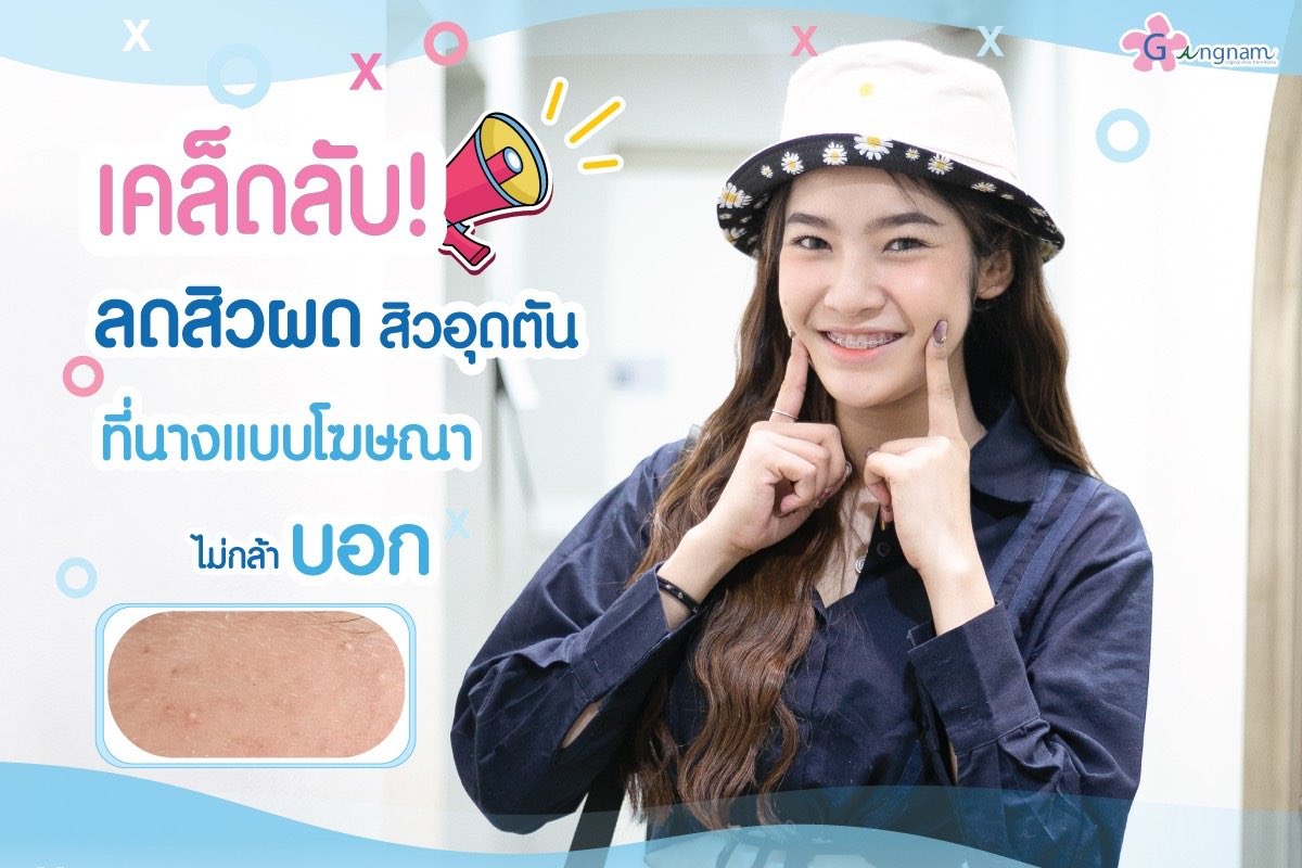 GangnamclinicT's tweet photo. ออนนี่มาบอกเทคนิคหน้าใสแบบไม่มีกั๊ก🤫
กับเคล็ดลับลดสิวผด สิวอุดตัน ที่นางแบบโฆษณาไม่กล้าบอก! 

สนใจสอบถามเพิ่มเติมทักหาออนนี่ที่ Line ID : @gangnamclinic

#ฉีดมาเด้ #มาเด้หน้าใส #มาเด้คอลลาเจน #MadeCollagen #Made #ฉีดMade
#GangnamClinic
#กังนัมคลินิก https://t.co/IZEA68Pa5Z