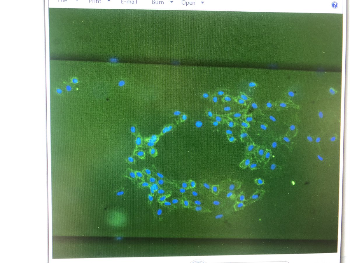 AbigailByford's tweet photo. Finally got my immunostaining working on my HUVECs cultured in my microfluidic devices! Here are some HUVECs stained with CD31 😍 Thanks to @VirginiaPensab2 @ElenaManci for the devices!!  #microfluidics #placenta #HUVECs https://t.co/QakwcZyepb