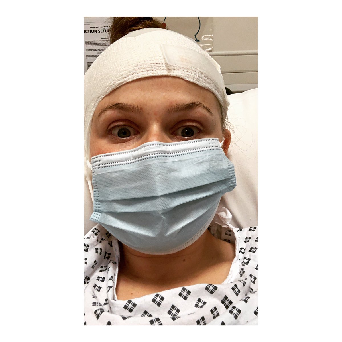 ZMusker's tweet photo. It’s nearly been 3 months since my #CochlearImplant surgery. Big up me not dying🤣 on a serious note though, CIs are the worlds most successful prostheses in that less than 0.2% reject or do not use it & the failure rate needing re-implantation is around 0.5% 📖🤟🏼🦻🏽 https://t.co/tbpgthJMS3