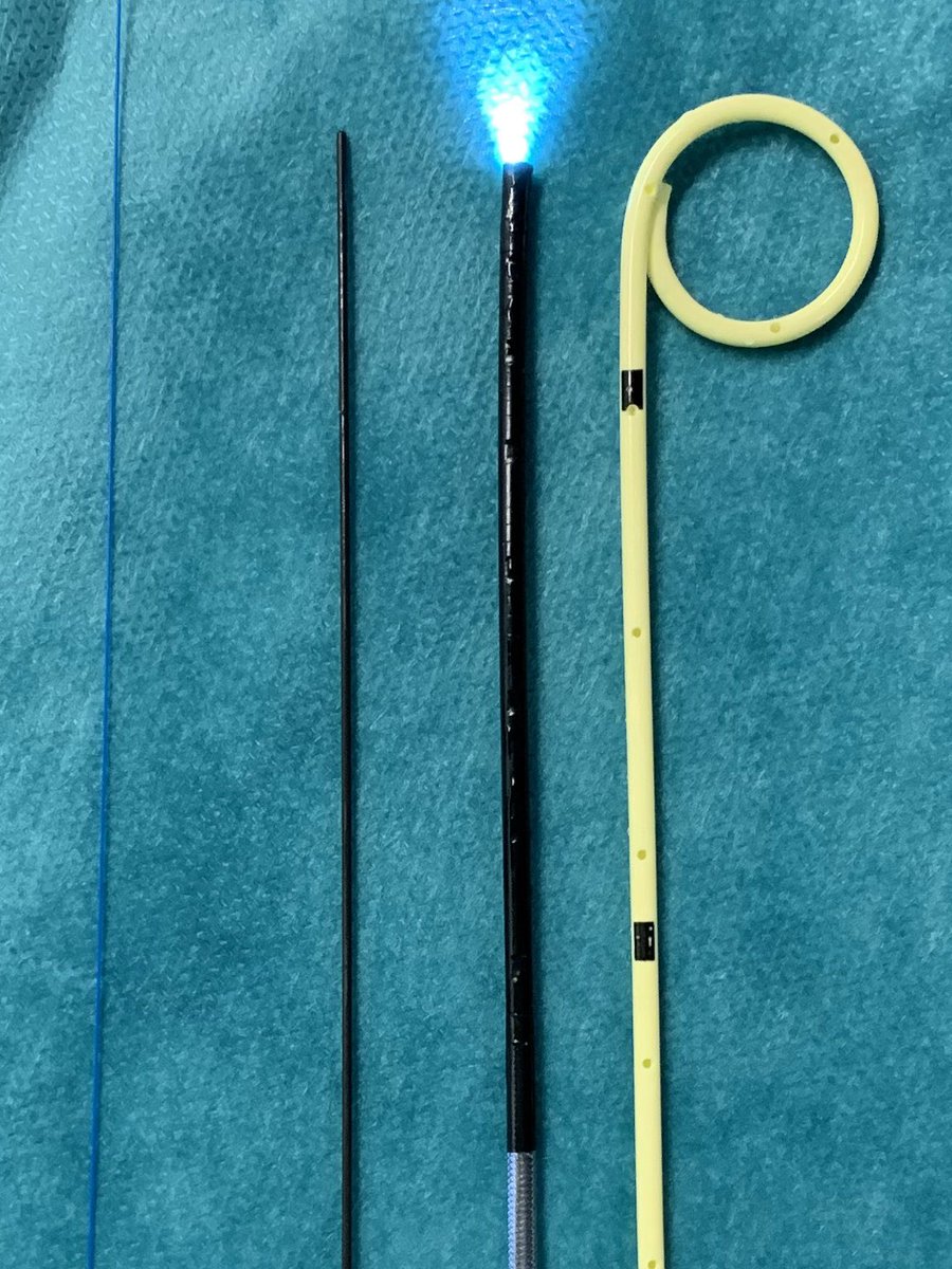 BN43: First use of the NEW SingleUse (SU)digital Flexi-URS 7,5Fr (Pusen). Today this is the smallest SU Digital F-URS. A bit bigger than regular 7Fr JJ. It opens the door for the future to treat stone in emergency &amp; not place a JJ. Not yet recommended but must be investigated