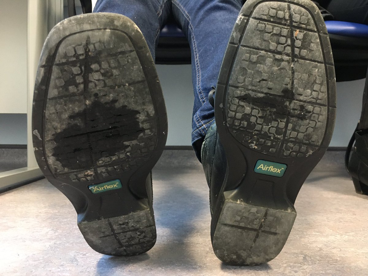 DrSandyThomson's tweet photo. Monday afternoon clinic. 
Simple observation of the patient helping with movement disorder diagnosis: look at the shoes. 

With kind permission of patient. https://t.co/CbOv0UPmNJ