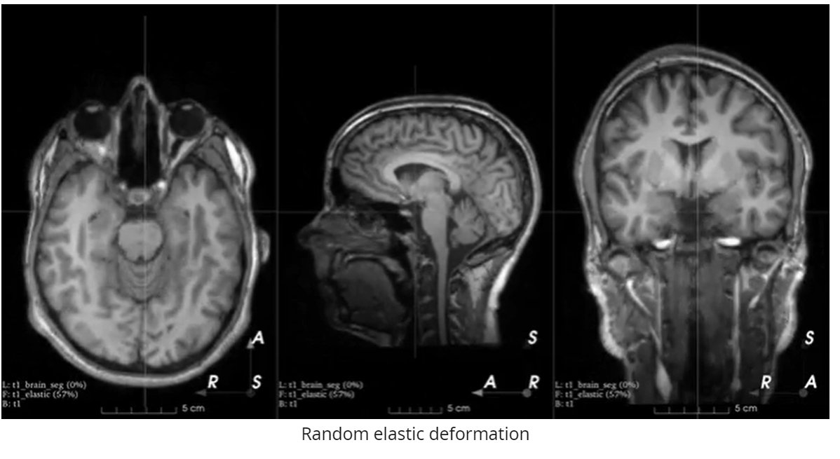 HumanCenterAI's tweet photo. Introducing #TorchIO- A #Python Library for 3-D Medical Imaging!
https://t.co/RfF2MmmJpU via @slashML
#100DaysOfCode #AI #AR #ArtificialIntelligence #Coding #DataScience #DigitalTransformation #FinServ #Flutter #IoT #JavaScript #MachineLearning #NodeJS #Tech #VR #WomenWhoCode https://t.co/z5nlx054HE