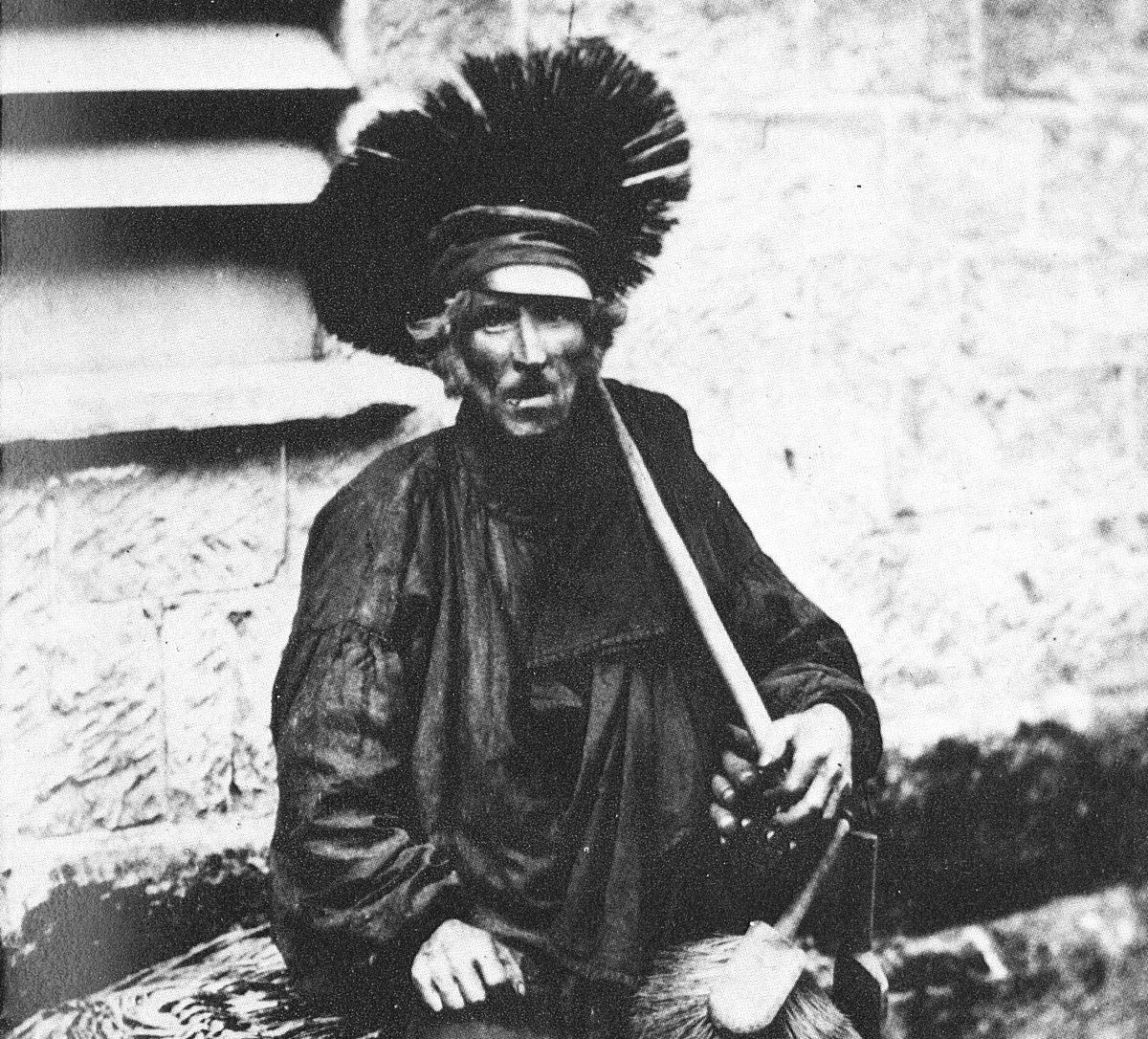 25. The very first work-related illness ever documented was called CHIMNEYSWEEP’S SCROTUM, in 1775.