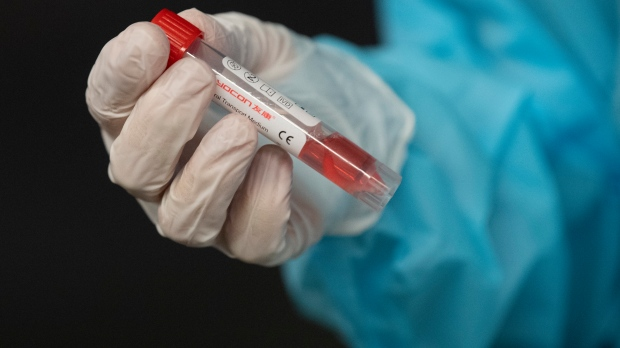 CP24's tweet photo. There are now 34 confirmed cases of B117 variant in Ontario and Toronto's top doctor says you should assume it is spreading https://t.co/VhmjiQeWP9 https://t.co/f3VJsMMcAO