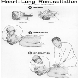 Eventually Dr. Safar's discovery found a kindred spirit in Dr. Kouwenhoven who had realized that external chest compressions could sustain circulation long enough to get the patient to a defibrillator As they learn in kindergarten, sometimes 1 + 2 = 4 and CPR was born!