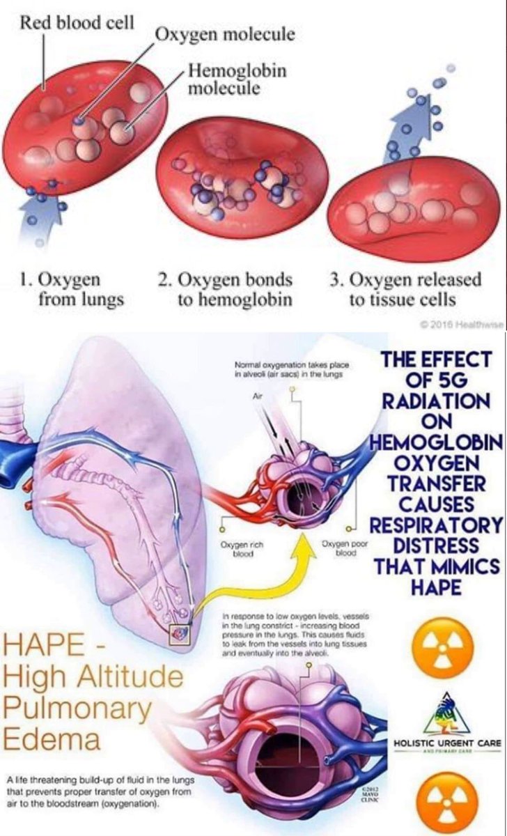 agvBruceAdams's tweet photo. Here is a sad and horrific report from Kenya about 5G, CV, Vaxx, and nanotech.  Protect yourself against this poison as much as you can. https://t.co/376mdvAZ5P