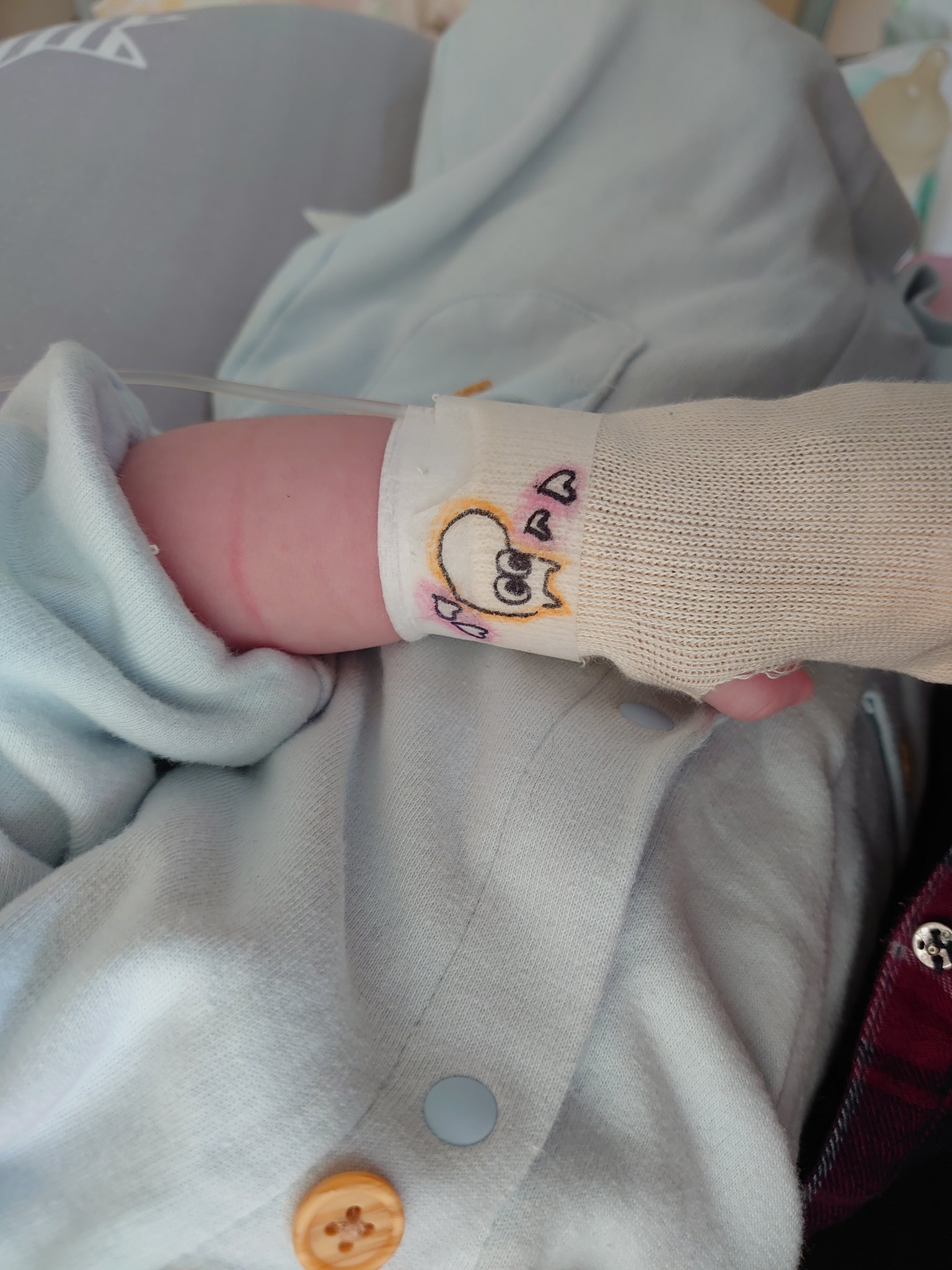 みるか 点滴の腕に巻いてる包帯テープに看護師さんが毎日かわいい絵を描いてくれてる 今日はムーミン T Co Fx6hcefp6h Twitter