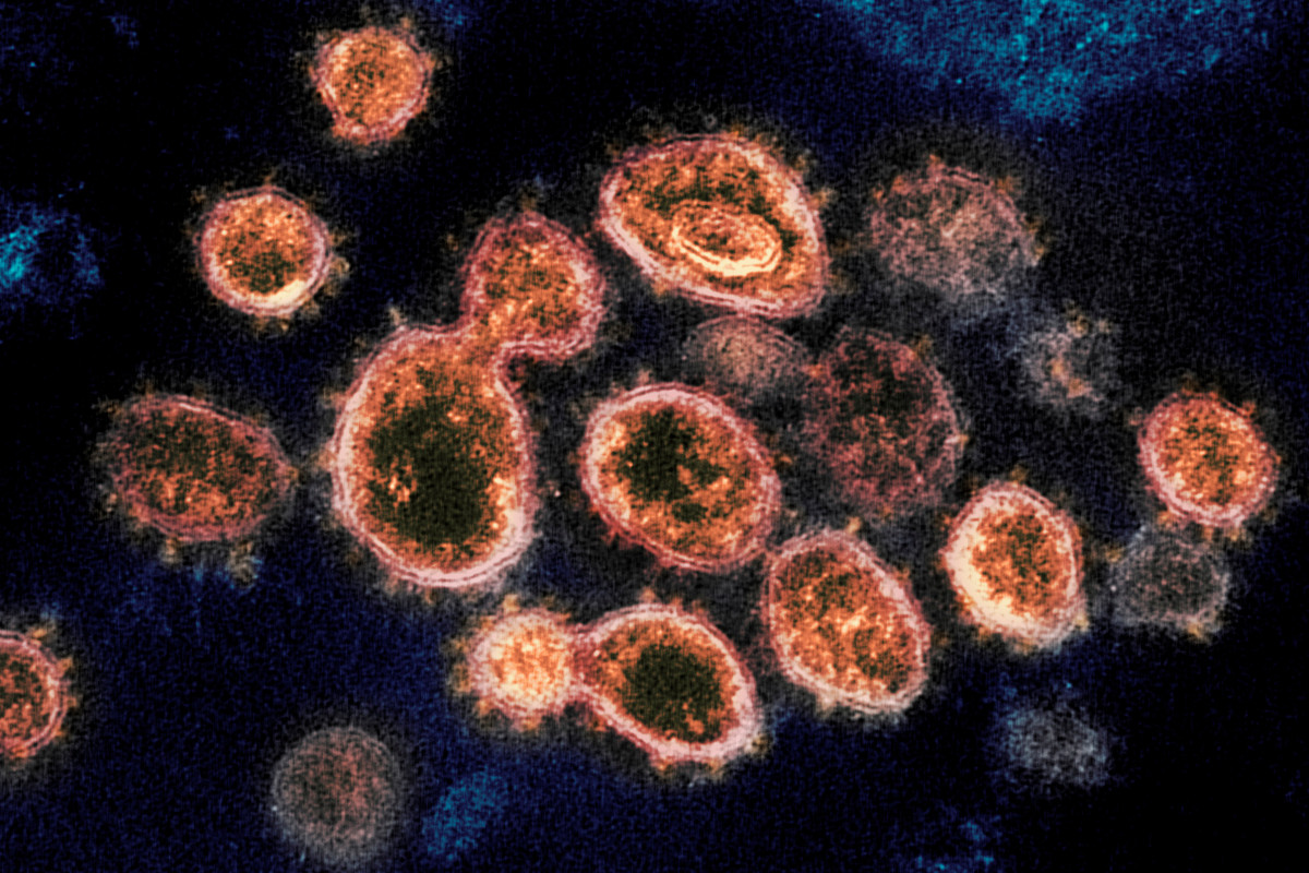 nypost's tweet photo. California may have its own highly contagious homegrown COVID-19 strain https://t.co/7eGOMasZXd https://t.co/cg9hWfTWzu