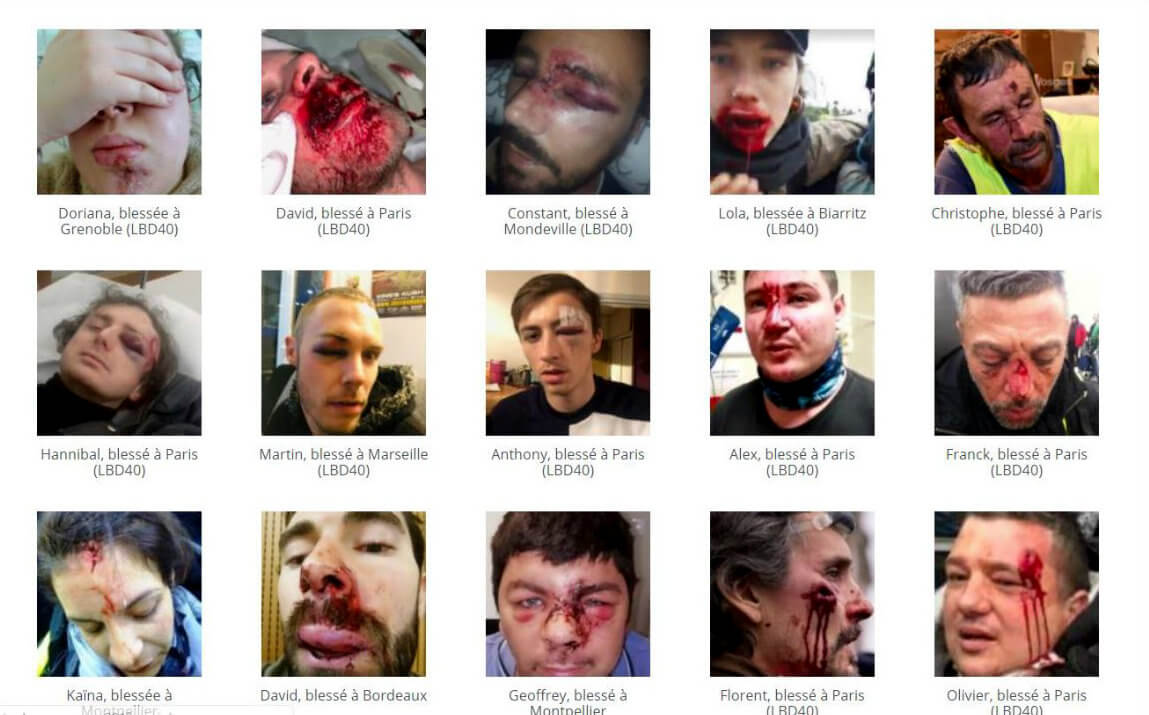 which appears to be a favorite target of the national police in France." https://www.mintpressnews.com/macron-lbd40-tactics-yellow-vests-public-safety-global-politics/254782/