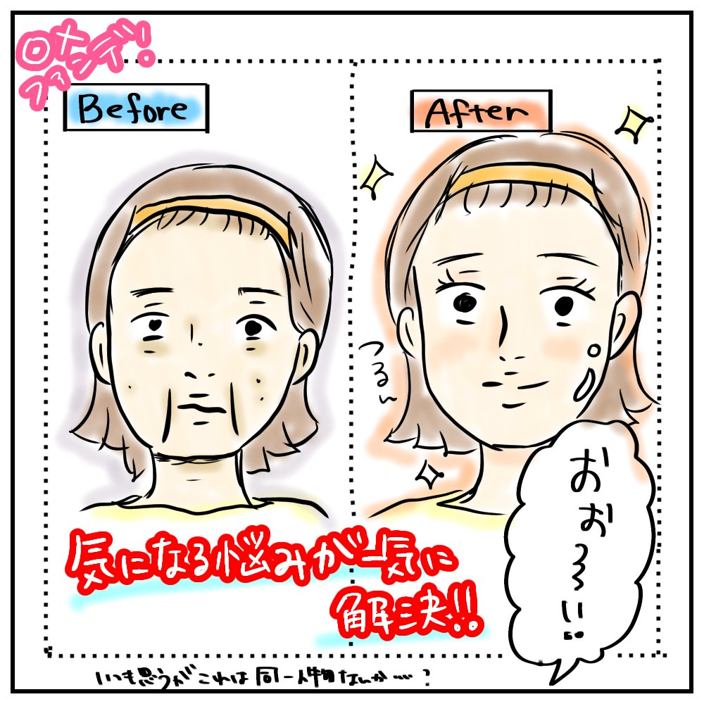 ムスメの懸命なフォローがさらにえぐってくる、って話。
ちなみにシミじゃなくて毛穴ね?
ムスメちゃん、よーく覚えといて❤️
#育児絵日記
#育児漫画
#日常漫画
#サコサコさんちのムスメちゃん