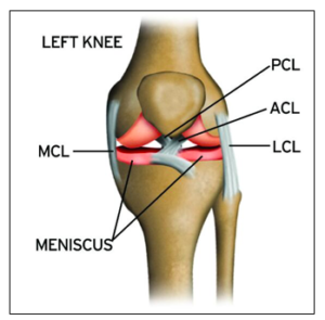 LIGAMENT / MENISCAL TEARS You have Medial Ligaments (MCL) , & Lateral Ligaments (LCL) and Meniscus structures. Common pain / symptoms: - Instability - Twisting of Knee (typically with planted foot) - Meniscus will have popping/locking/ clicking - Direct blow to KNEE.