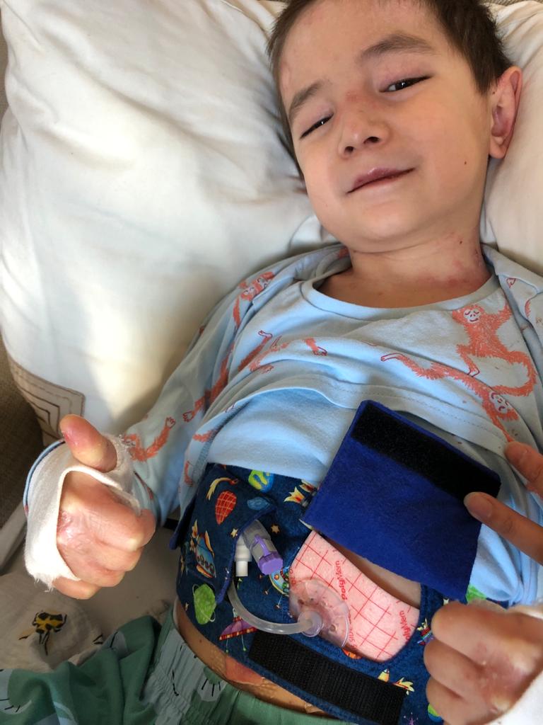LyppardMrsThorp's tweet photo. @LyppardSchool sends virtual hugs and lots of love to Jamie (Y2). We are delighted that his surgery went well and that he is now safely back at home. Jamie is thrilled that his new tube means he no longer has to taste his medicine! We are looking forward to seeing you soon Jamie! https://t.co/Enb8qYgGHs
