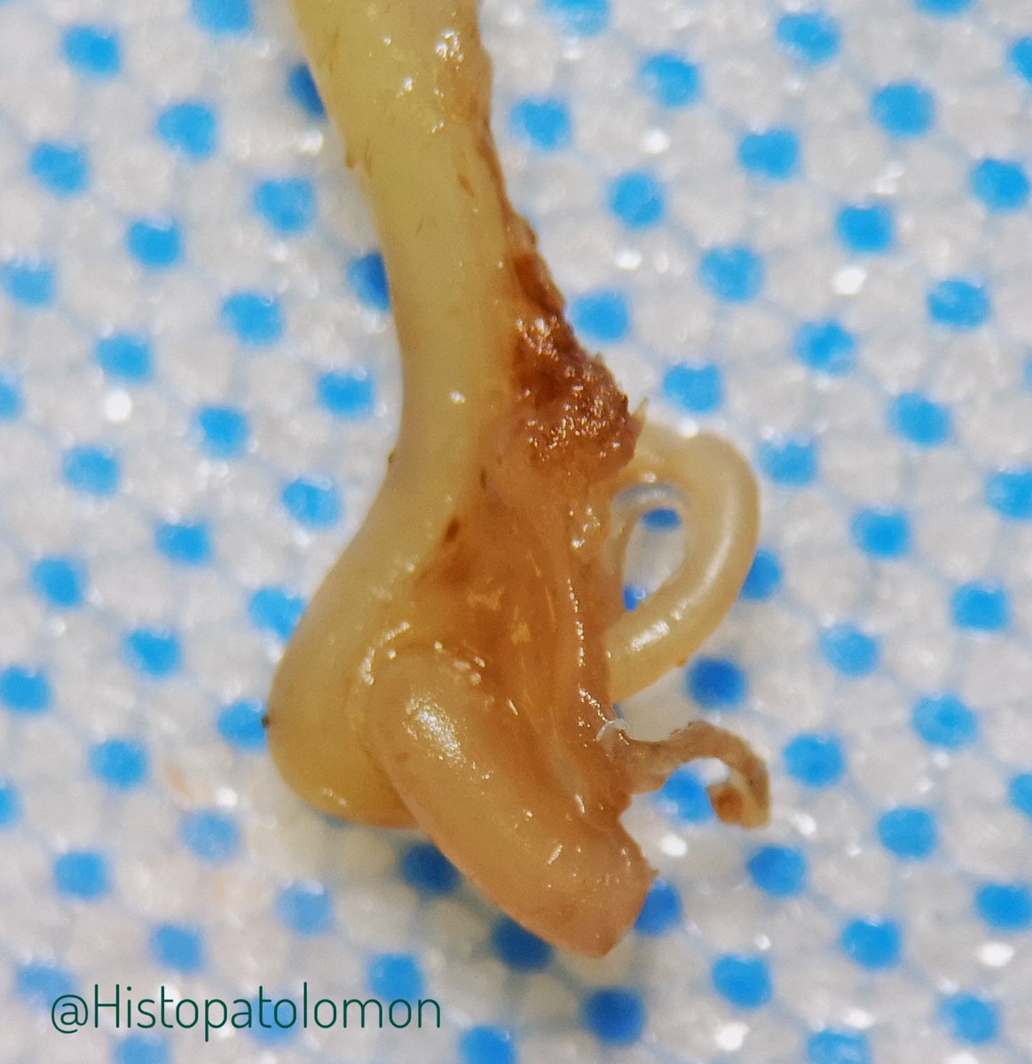 Today a 13-week fetus arrived. I was curious if the Peyer's patches and Paneth's cells is already there. What do you think? Poll 