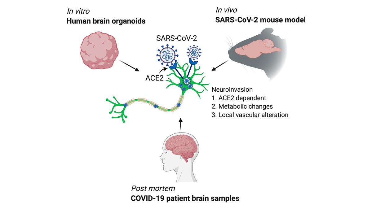 #Neurological symptoms are frequently observed in #COVID19. Using 3 approaches - mouse model, human brain #organoids & autopsies of COVID-19 patients, Song @ericsongg, Iwasaki @virusesimmunity and colleagues demonstrate evidence of #SARSCoV2 neuroinvasion bit.ly/38BjLbA