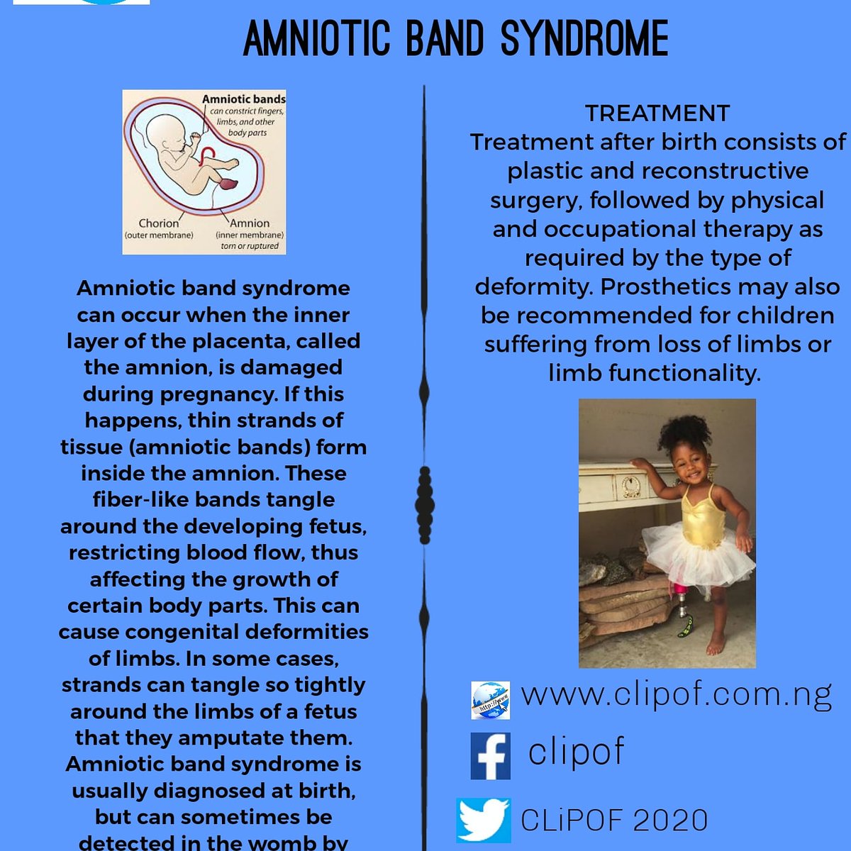 CLiPOF2020's tweet image. Some people were born without limb and it's not a spiritual attack.
#change your perception about DISability