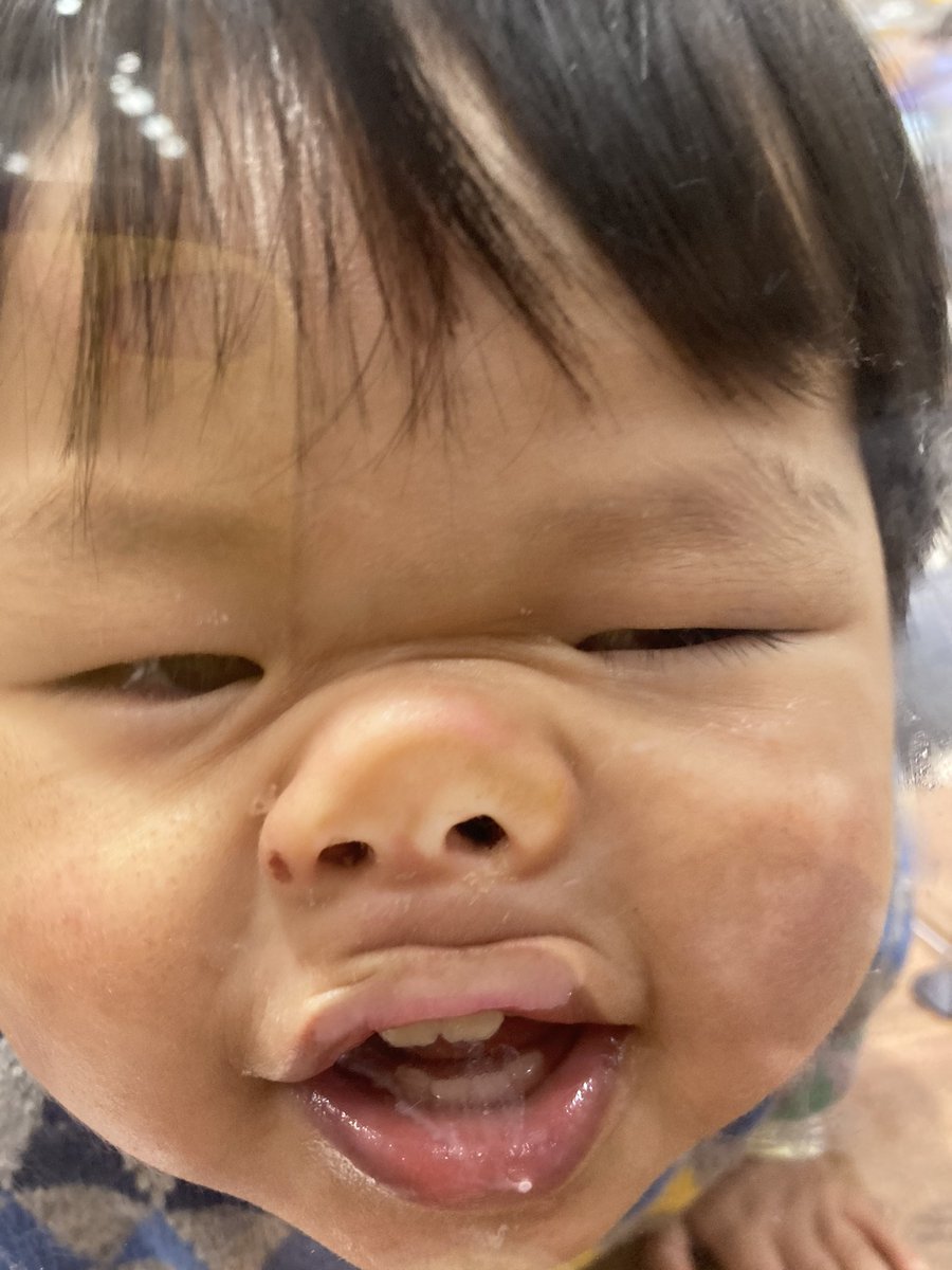 赤ちゃん変顔 Twitter Search Twitter 赤ちゃん変顔 Twitter Search Twitter